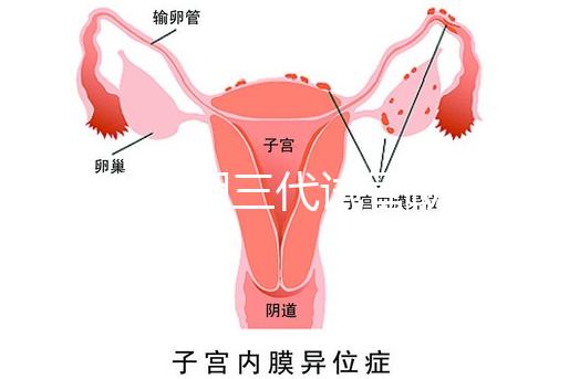 2025昆明三代試管助孕費用一覽，8-15萬元，價格透明公開自主選擇