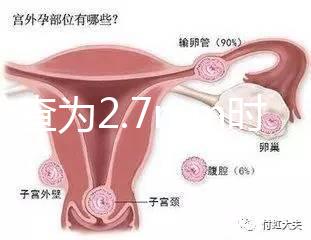 nt檢查為2.7mm時危險性莫亂猜，做完無創后才能確定